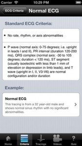 hd ecg for iphone